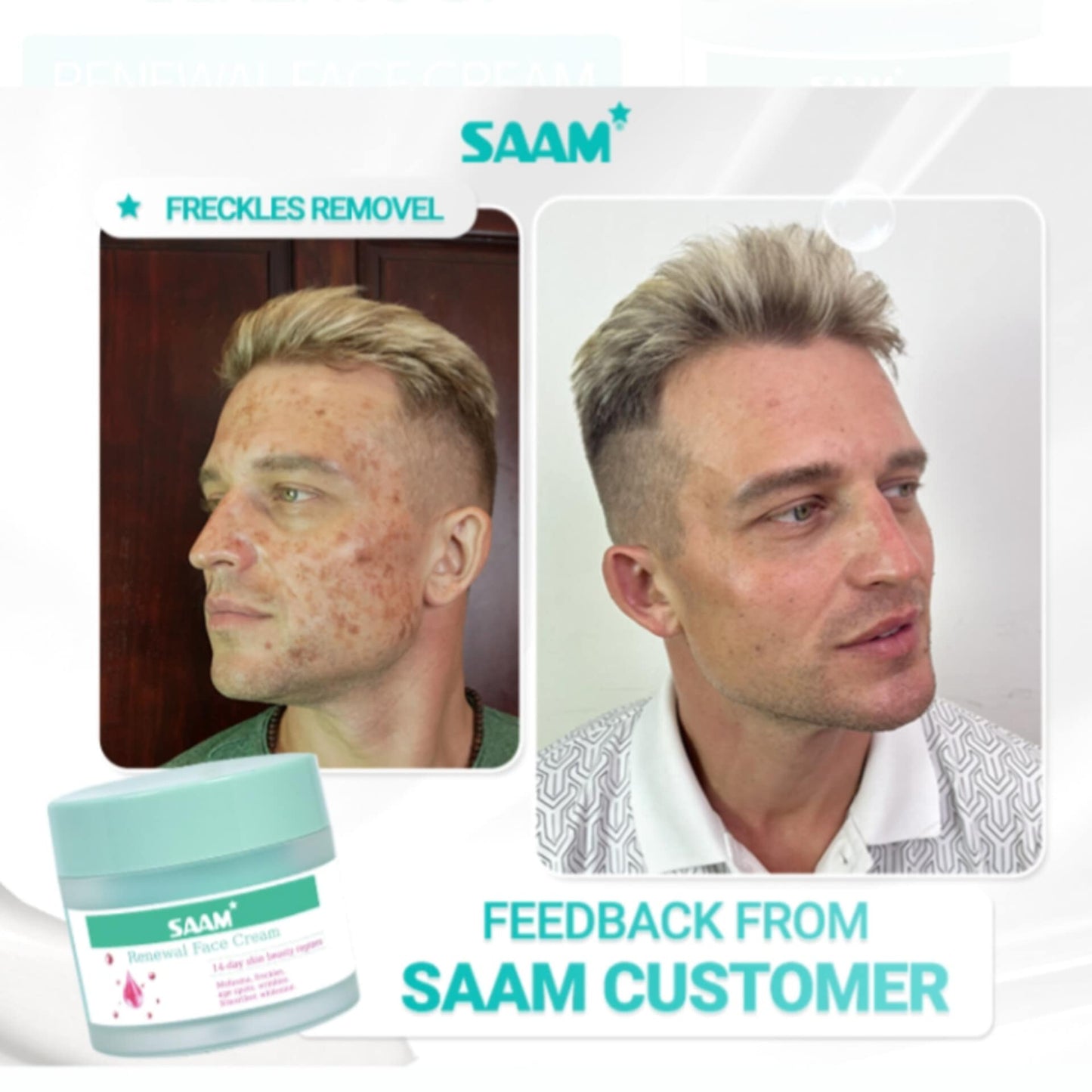 Creme Facial Renovador SAAM – Solução completa para melasma, sardas e manchas escuras