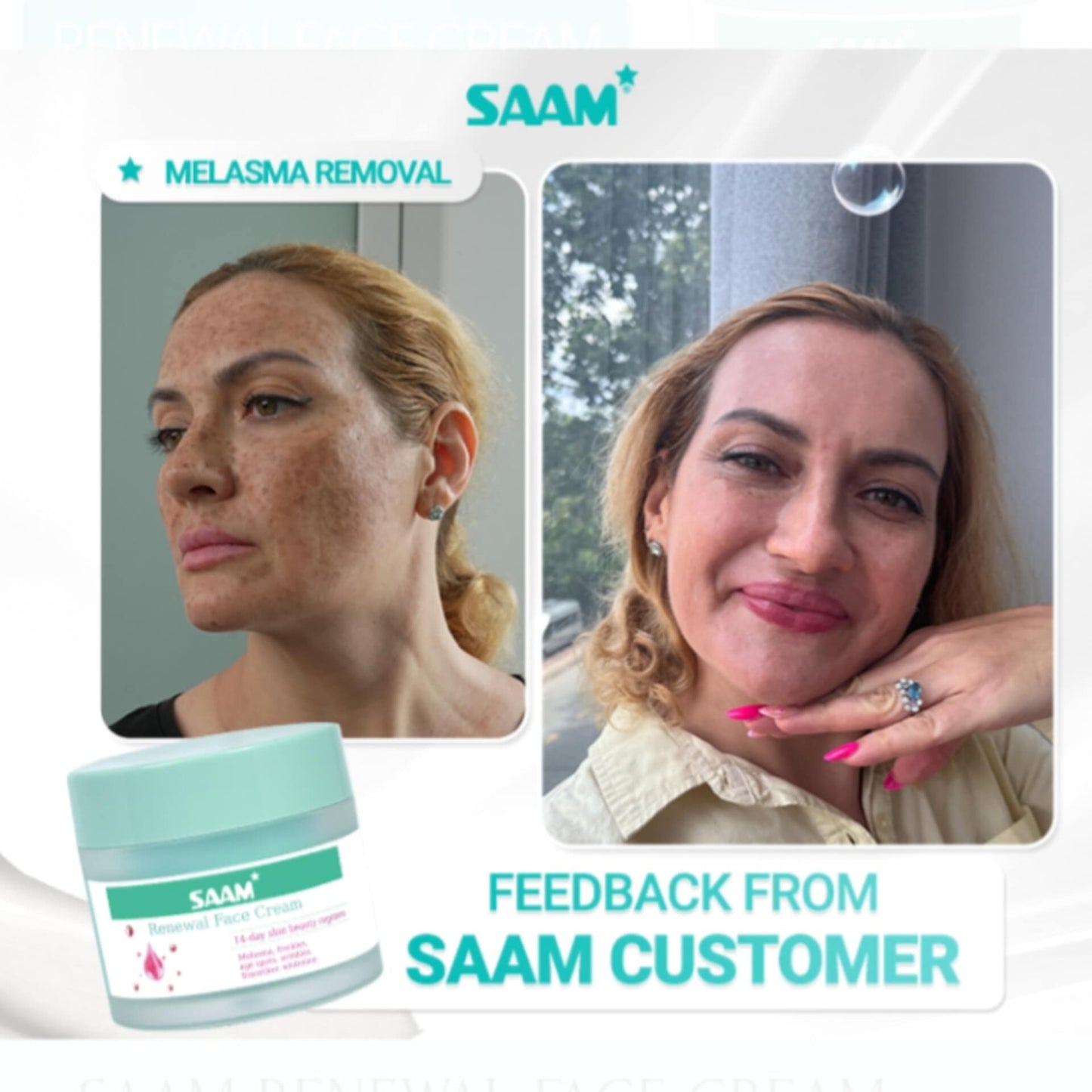 Creme Facial Renovador SAAM – Solução completa para melasma, sardas e manchas escuras