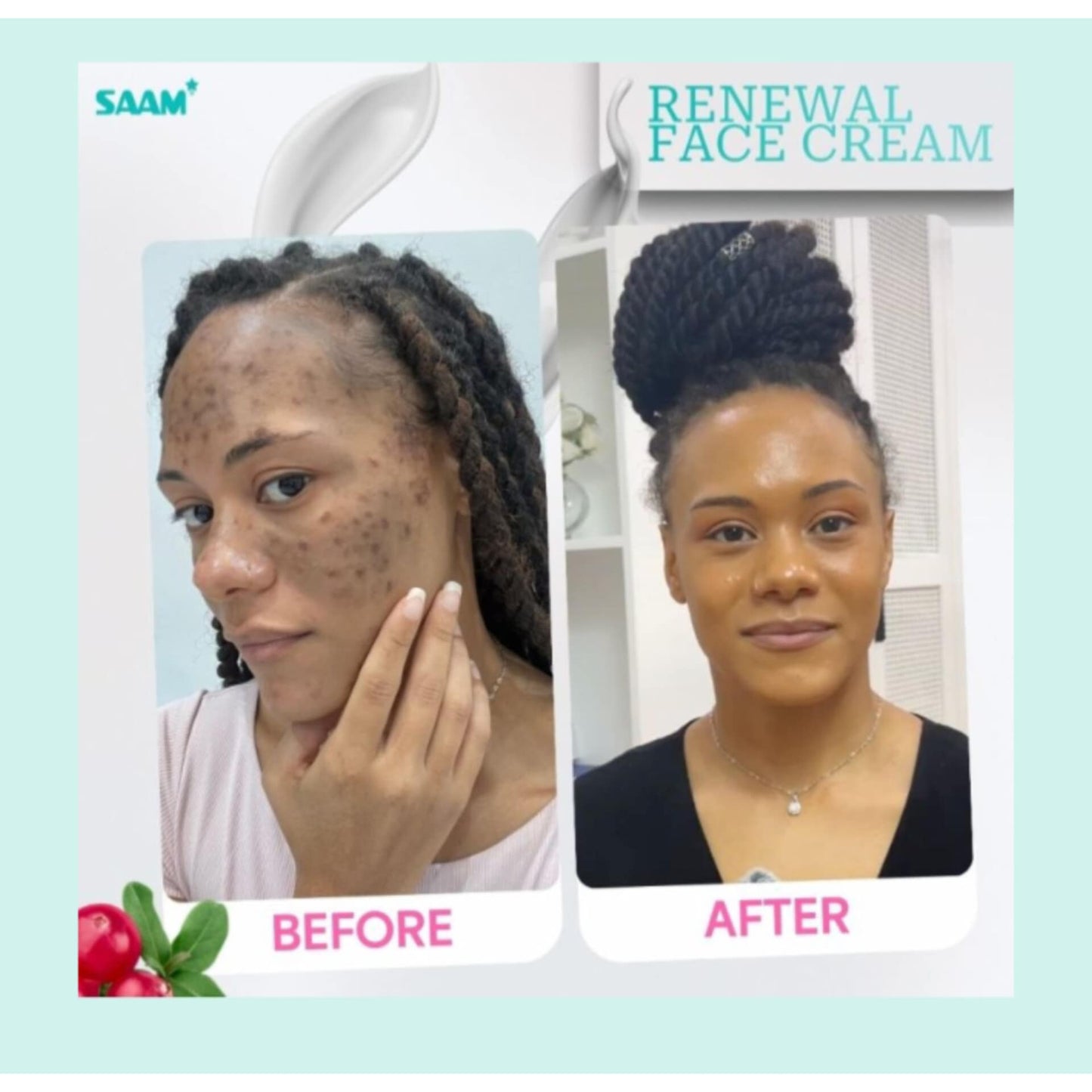 Creme Facial Renovador SAAM – Solução completa para melasma, sardas e manchas escuras